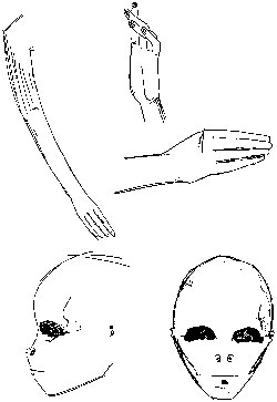 Dessin reproduisant ce que l'infirmi�re avait dessin� pour Dennis